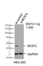 BCS1L Antibody in Western Blot (WB)