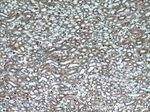 BCS1L Antibody in Immunohistochemistry (Paraffin) (IHC (P))