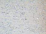 BCS1L Antibody in Immunohistochemistry (Paraffin) (IHC (P))