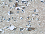 BCS1L Antibody in Immunohistochemistry (Paraffin) (IHC (P))