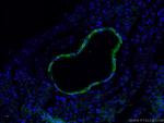 transgelin/SM22 Antibody in Immunohistochemistry (PFA fixed) (IHC (PFA))