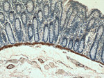 transgelin/SM22 Antibody in Immunohistochemistry (Paraffin) (IHC (P))