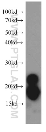 transgelin/SM22 Antibody in Western Blot (WB)