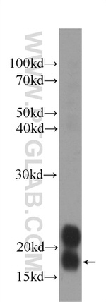 transgelin/SM22 Antibody in Western Blot (WB)