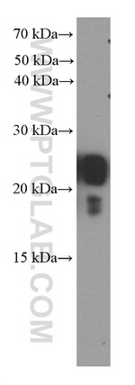 transgelin/SM22 Antibody in Western Blot (WB)