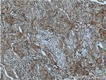 CXCR7 Antibody in Immunohistochemistry (Paraffin) (IHC (P))