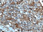 CXCR7 Antibody in Immunohistochemistry (Paraffin) (IHC (P))