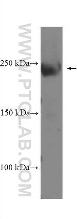 SMMHC Antibody in Western Blot (WB)