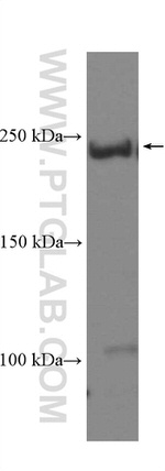 SMMHC Antibody in Western Blot (WB)