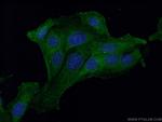 Galectin-1 Antibody in Immunocytochemistry (ICC/IF)