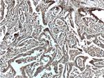 Galectin-1 Antibody in Immunohistochemistry (Paraffin) (IHC (P))