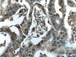 Galectin-1 Antibody in Immunohistochemistry (Paraffin) (IHC (P))