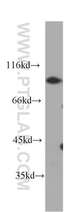 CD44 Antibody in Western Blot (WB)