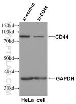 CD44 Antibody in Western Blot (WB)