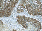 CD44 Antibody in Immunohistochemistry (Paraffin) (IHC (P))