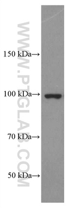 CD44 Antibody in Western Blot (WB)