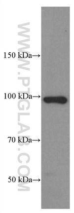 CD44 Antibody in Western Blot (WB)