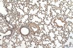 PI3K p85 alpha Antibody in Immunohistochemistry (Paraffin) (IHC (P))