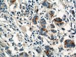 PI3K p85 alpha Antibody in Immunohistochemistry (Paraffin) (IHC (P))