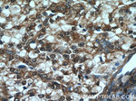 PI3K p85 alpha Antibody in Immunohistochemistry (Paraffin) (IHC (P))