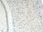 PI3K p85 alpha Antibody in Immunohistochemistry (Paraffin) (IHC (P))