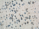 PI3K p85 alpha Antibody in Immunohistochemistry (Paraffin) (IHC (P))