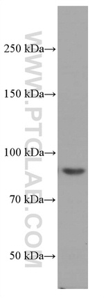 PI3K p85 alpha Antibody in Western Blot (WB)