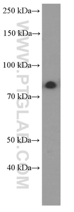 PI3K p85 alpha Antibody in Western Blot (WB)