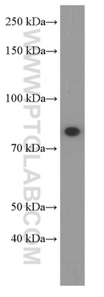 PI3K p85 alpha Antibody in Western Blot (WB)