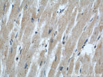 IFT88 Antibody in Immunohistochemistry (Paraffin) (IHC (P))