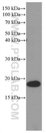 Myosin Light Chain 2 Antibody in Western Blot (WB)