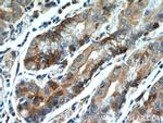 FUT9 Antibody in Immunohistochemistry (Paraffin) (IHC (P))