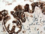 CD9 Antibody in Immunohistochemistry (Paraffin) (IHC (P))