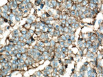 CD9 Antibody in Immunohistochemistry (Paraffin) (IHC (P))