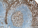 CD9 Antibody in Immunohistochemistry (Paraffin) (IHC (P))