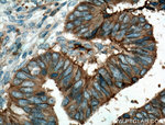 CD9 Antibody in Immunohistochemistry (Paraffin) (IHC (P))