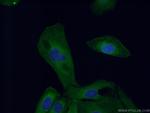 MYH9 Antibody in Immunocytochemistry (ICC/IF)