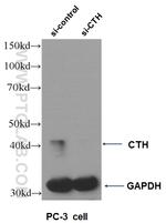 Gamma cystathionase Antibody in Western Blot (WB)