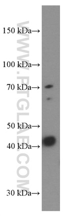 Gamma cystathionase Antibody in Western Blot (WB)