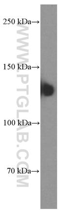 NCAM1/CD56 Antibody in Western Blot (WB)