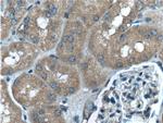 PLAA Antibody in Immunohistochemistry (Paraffin) (IHC (P))