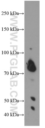 PLAA Antibody in Western Blot (WB)