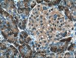 4EBP1 Antibody in Immunohistochemistry (Paraffin) (IHC (P))