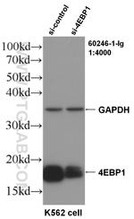 4EBP1 Antibody in Western Blot (WB)