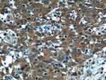 4EBP1 Antibody in Immunohistochemistry (Paraffin) (IHC (P))