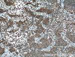 4EBP1 Antibody in Immunohistochemistry (Paraffin) (IHC (P))