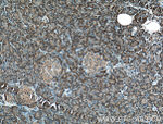 4EBP1 Antibody in Immunohistochemistry (Paraffin) (IHC (P))