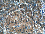 4EBP1 Antibody in Immunohistochemistry (Paraffin) (IHC (P))