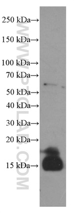 4EBP1 Antibody in Western Blot (WB)