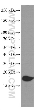 4EBP1 Antibody in Western Blot (WB)